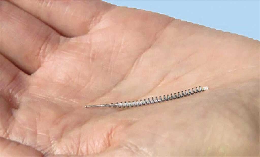 Essure: ¿se sabían realmente los riesgos?